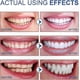 thumbnail image 5 of Mint-Infused Whitening Toothpaste, Fluoride-Free Formula for Brighter Teeth and Gum Health, 5 of 5