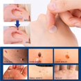 thumbnail image 4 of Soidarity Pack of 108 Simple Patch Workmanship Safety Conceal Removal Patches Operation Skins Removing Tool Unisex Care Type1 NO1 Soidarity CE001964-00, 4 of 6