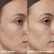 thumbnail image 3 of Aceite facial e.l.f. SKIN PLZ Clarify 30 ml con ácido salicílico, 3 of 9