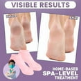 thumbnail image 3 of 5 Pairs Silicone Socks for Dry Cracked Feet - Women's Moisturizing Foot Socks, Cracked Heel Treatment (5 Colors Assorted, Fits Up to Size 9), 3 of 10
