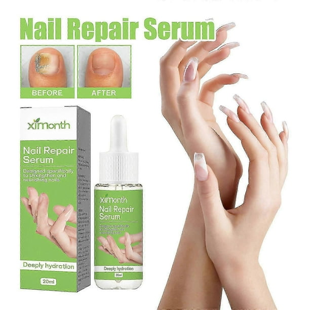 Nail Repair Essence, Onychomycosis on Hands and Feet, Soft Nails, Bright Nails, Thickening Toenails Cleaning Care Cu