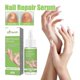 thumbnail image 1 of Nail Repair Essence, Onychomycosis on Hands and Feet, Soft Nails, Bright Nails, Thickening Toenails Cleaning Care Cu, 1 of 5