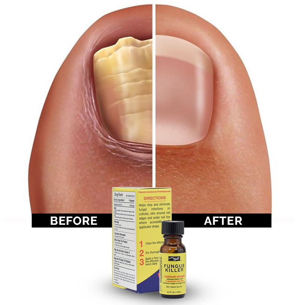 Dr.MOQLIN 保湿ローション PRO & Fungus C-15 Hydro-Screen Serum for Face, Neck, and Hand Skin - NassifMDÂ