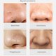 thumbnail image 2 of Blackhead Remover Mask Herramientas de limpieza profunda facial contra puntos 01 Black, 2 of 8