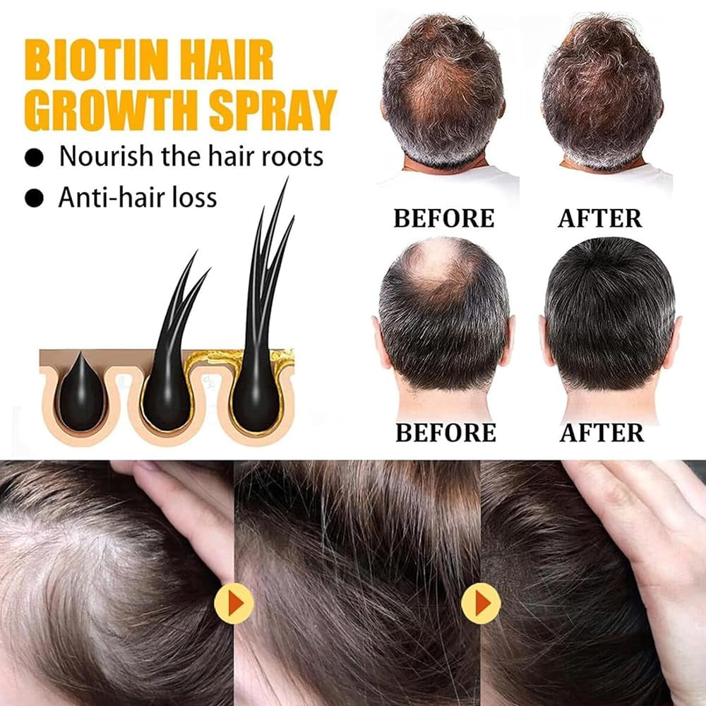 Biotin Haarwuchs Serum & Spray – Fördert Haarwachstum, Gegen Haarausfall & Für Geschädigtes Haar