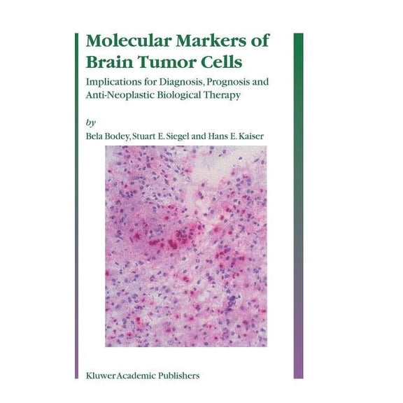 Molecular Markers of Brain Tumor Cells: Implications for Diagnosis, Prognosis and Anti-Neoplastic Biological Therapy, (Hardcover)