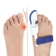 thumbnail image 4 of 1 par de correctores de Hallux Valgus, separadores invisibles para corrección de Hallux Valgus, férulas para el cuidado de los pies de mujeres y hombres, 4 of 5