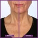 thumbnail image 2 of Crema reafirmante para cuello PRAI Ageless Throat & Escote Creme, 2 of 8