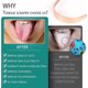 thumbnail image 4 of Raspador de lengua de cobre puro con estuche de transporte - Juego de 2 - Naturalmente antimicrobiano, elimina el mal aliento y mantiene la higiene bucal, raspador de lengua F, 4 of 5