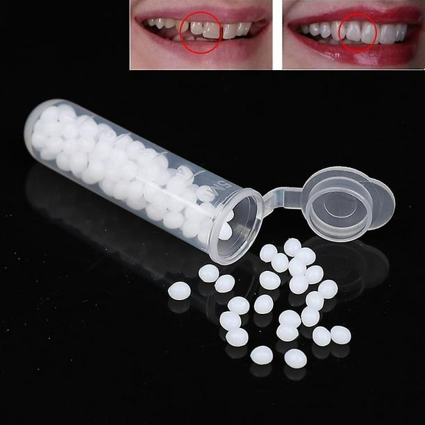 Colle de dent Kit de colle de soin dentaire d'opération simple de