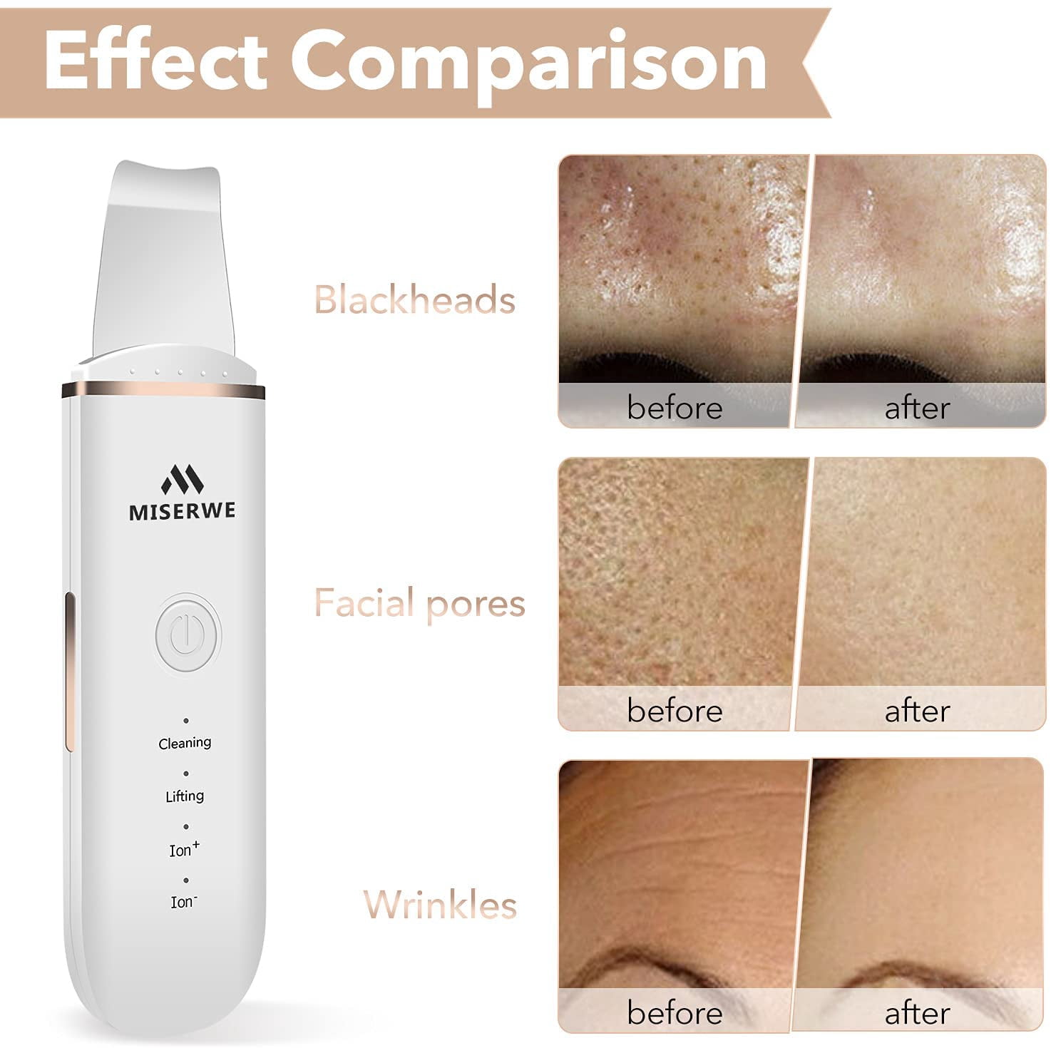 Skin Scrubber Face Skin Spatula Facial Scrubber Spatula for Deep Cleansing Blackhead Remover Pore Cleaner Face Beauty Lifting Tool with 4 Modes
