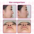 thumbnail image 4 of Ruban Amincissant pour le Nez Résistant à la Transpiration Outils de Beauté Ruban Auto-Adhésif Contour des Ailes du Nez Réglable Imperméable Respirant Patch de Levage du Nez Usage Quotidien, 4 of 8