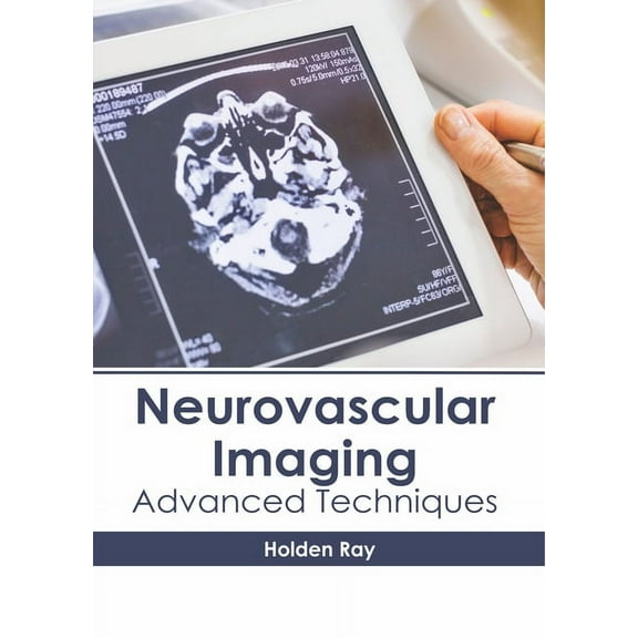 Neurovascular Imaging: Advanced Techniques, (Hardcover)
