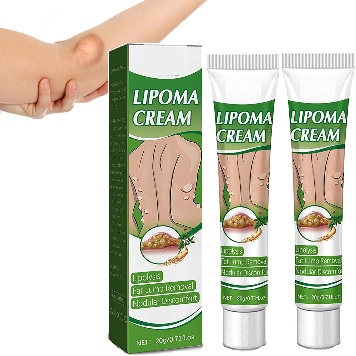 Lipomacure Soothing Ointment Lumpfree Lipoma Removal Creamlipoma Creamlipolysis Creamlipoma 