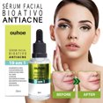 thumbnail image 1 of Suero facial Xihbxyly bioactivo antiacné 10 en 1 30 ml, 1 of 7
