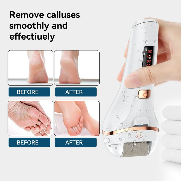 Electric Foot Callus Removers, Rechargeable Portable Electronic