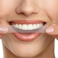 thumbnail image 3 of 28Pcs / Pack Tiras blanqueadoras de dientes Removedor de manchas de té de aclarado instantáneo Zulema Tiras blanqueadoras de dientes, 3 of 8