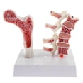 thumbnail image 2 of 1:1 Human Lumbar Vertebra Thighbone Osteoporosis Pathology Model Kit, 2 of 9