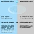 Microneedle Acne Patches by Care Me Best Healing Treatment for