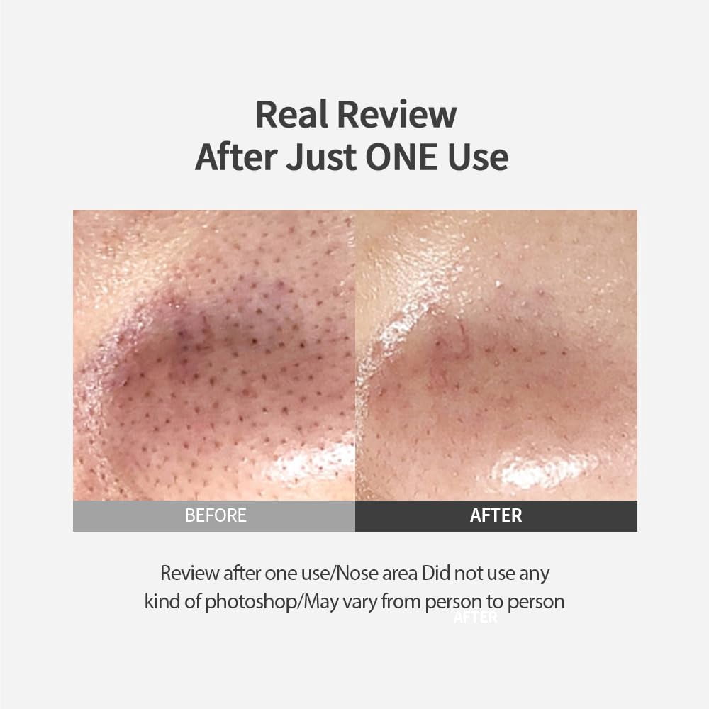 SUNGBOON EDITOR Blackhead Melting Clear Pad 65g(30 counts) | Blackhead Remover Pad, Pore Minimizing | Deep Cleansing & Pore Unclogging | Clears Blackhaed| Korean Skincare