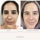 thumbnail image 2 of Set Antiedad Nunun Skin Cuidado en Piel, 2 of 8