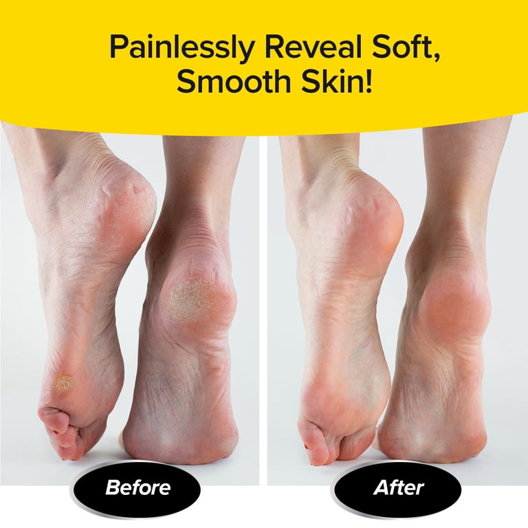 Ped Egg Professional Foot File, Ultimate Edition photo 6