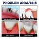 thumbnail image 5 of 1/3/5x Toothache Spray Instant Pain Relief Oral Teeth Care Effective Treatment New, 5 of 5