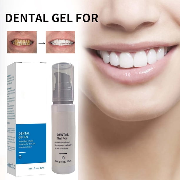 30 ml de gel de pasta de dientes Mint Fresh Breath de tamaño de viaje con fórmula de espuma de limpieza profunda - Solución de cuidado bucal suave con el esmalte para uso diario - Diseño compacto y