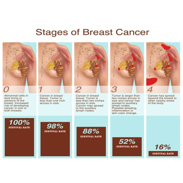 can breast cancer travel through blood