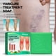 thumbnail image 3 of Minnieouse Eliminador de varices de extracción Natural, de viaje, circulación sanguínea, herramienta de eliminación de venas varicosas, Protección de la piel, 3 of 6
