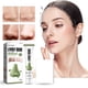 thumbnail image 1 of Fiudx Mascarilla para Puntos Negros, Tratamiento Facial con Extracto de Té Verde, Papel Desprendible de 15 G Incluido, Limpieza Profunda de Poros, Control de Grasa para Una Piel Fresca, Rutina Diaria, 1 of 6