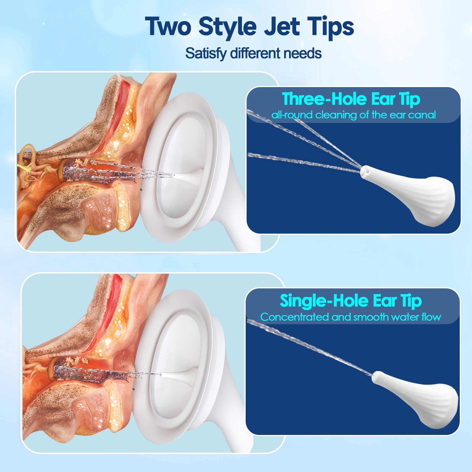 Morfone Ear Wax Removal Kit, Ear Cleaner with One-Piece Waste Tank, 4 Pressure Mode,2 Style Tips, Effective Ear Irrigation Flushing System & USB-C Cable, IPX6, White