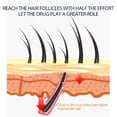 thumbnail image 2 of Spray para El Crecimiento Del 100 Ml 5 % Minoxidil Hombres Y Mujeres Tratamiento, 2 of 9