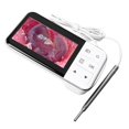thumbnail image 5 of Digital Otoscope Visual Comfortable Ear Camera Earpick Ear Wax Removal Tool with 4.5in Display, 5 of 5