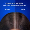 thumbnail image 5 of Head & Shoulders Anti-Hair fall Shampoo, Anti-Dandruff Shampoo for Women & Men 650ml, 5 of 10