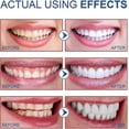 thumbnail image 5 of SP-6 Probiotic Whitening Toothpaste, Sp-6 Ultra Whitening Toothpaste for Teeth Whitening, Fresh Breath and Gum Health, Fluoride-Free Fresh Mint Flavor, 5 of 5