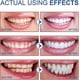 thumbnail image 5 of SP-6 Probiotic Whitening Toothpaste, Sp-6 Ultra Whitening Toothpaste for Teeth Whitening, Fresh Breath and Gum Health, Fluoride-Free Fresh Mint Flavor, 5 of 5