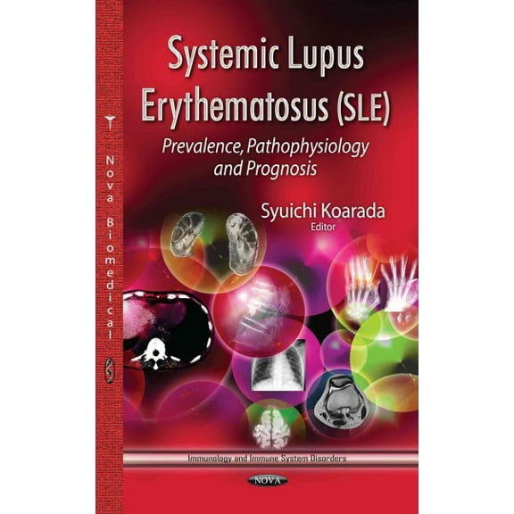 Systemic Lupus Erythematosus, Sle : Prevalence, Pathophysiology and Prognosis