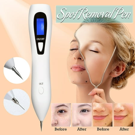 Mole Remover Portable Rechargeable Mole Removal Pen for Face Body Self Black Raised Mole Skin Tag Wart Dark Sun Age Spot Blemish Tattoo Security Removal
