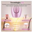 thumbnail image 5 of Ipl Depiladora  Wünd De Luz Pulsada Laser Permanente Sin Dolor Modelo Rosa, 5 of 5