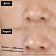 thumbnail image 3 of Kiehl's Dermatologist Solutions - Clearly Corrective Serum, Suero Facial Iluminador, disminuye la apariencia de las manchas oscuras y cicatrices del, 3 of 8
