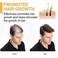 thumbnail image 3 of Ginger Black Hair Conditioner Ginger Essence Repairs Damaged Hair And Black Hair Softenin, 3 of 5
