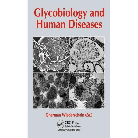 Glycobiology and Human Diseases, (Hardcover)