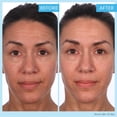thumbnail image 4 of Crema antienvejecimiento SKINN Crème Reverse Intensive 50 ml, 4 of 7