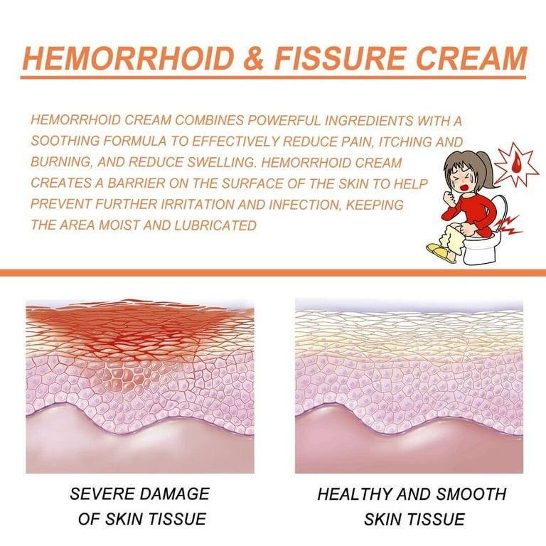 Reejoys Hemorrhoid Cream, Hemorrhoid Treatment, Hemorrhoid & Fissure  Ointment, Fast Relief Hemorrhoid Cream Healing Formula, Hemorrhoid Symptom