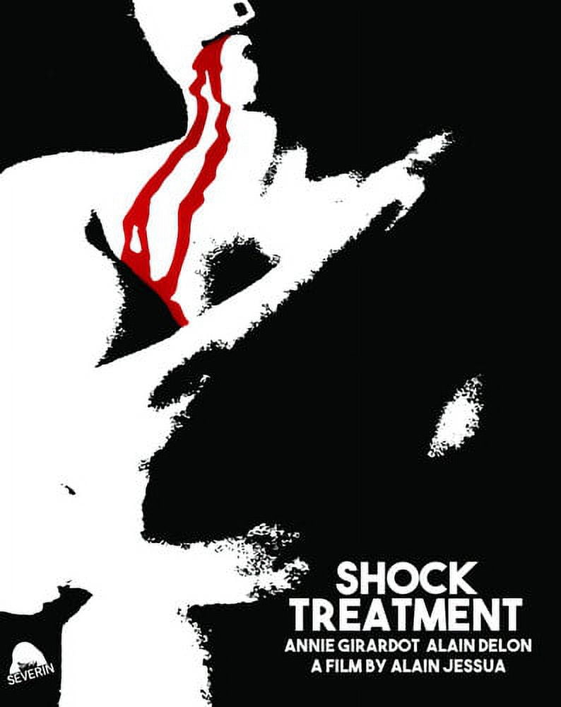 Shock Treatment (25th Anniversary Edition) - Walmart.com