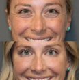 thumbnail image 4 of Instant Firm Eye Tightener, Eye Bag Cream, Instant Firm Eye Cream, 4 of 4