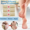 Wart Remover Wart Removal Plasters Pad Foot Warts Removal Anti Warts