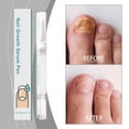 Nail Growth Pen Fast Promote Growth Fast Strength Long Intelligent Nail