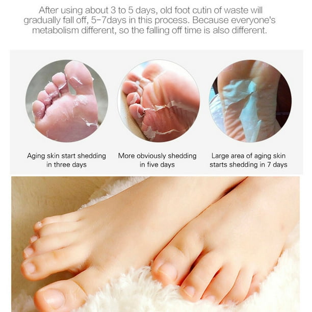 Chaussette de Pied Exfoliante Pedicure Callus Peeling du Pied Patch Chaussette Unisexe Peeling Feuille Detachant de la Peau Morte Lavande